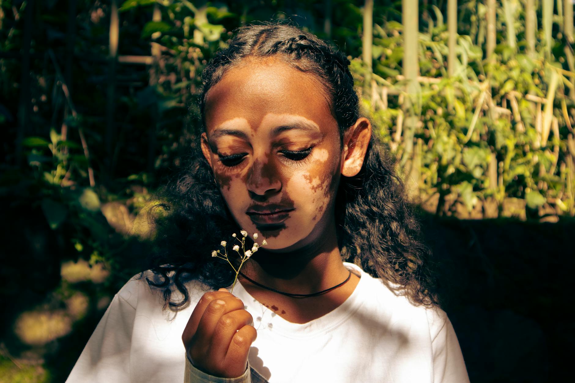 Common Underlying Conditions Linked to Hormonal Acne