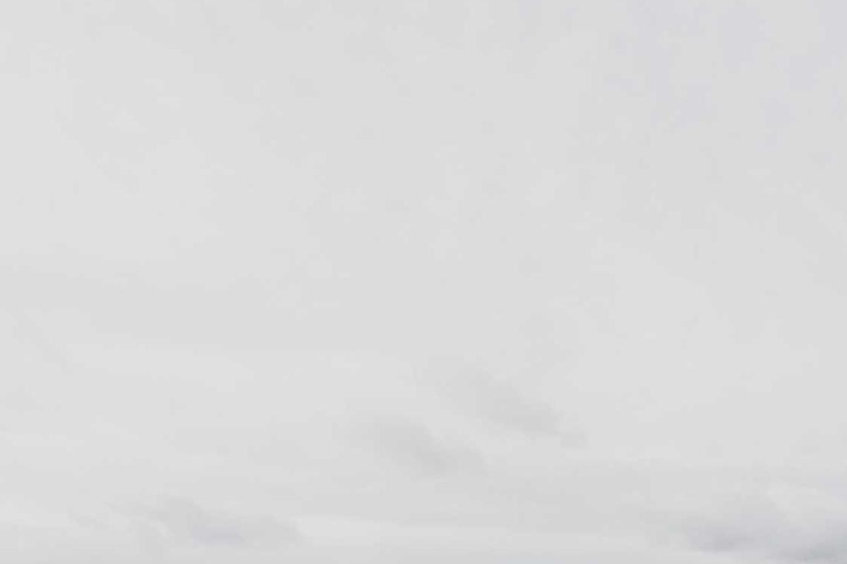 What Causes Acne on Temples and Hairline Area - Illustration 2