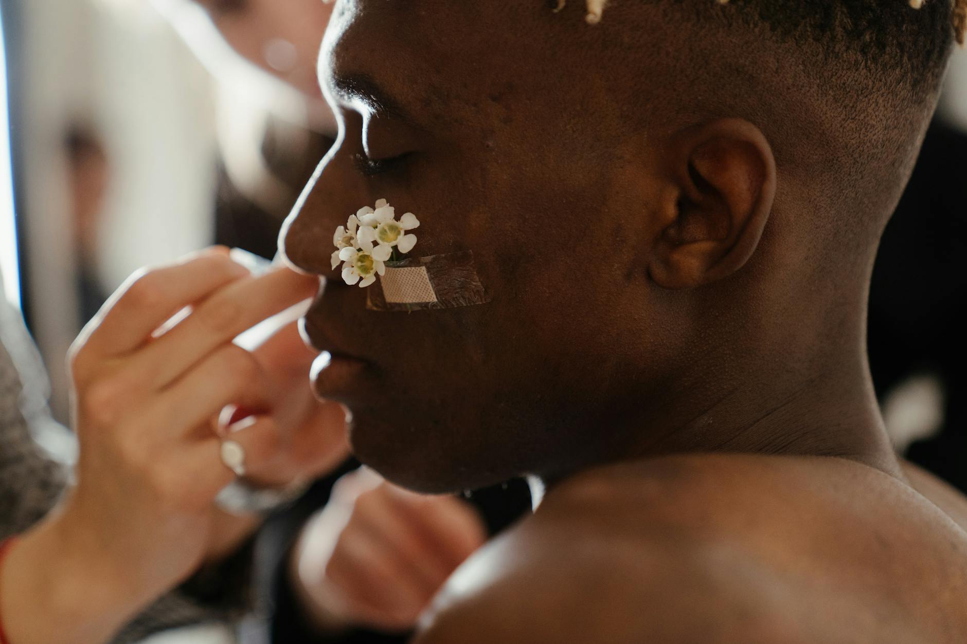 Acne Industry Expansion Driven by Social Media Transparency - Featured image