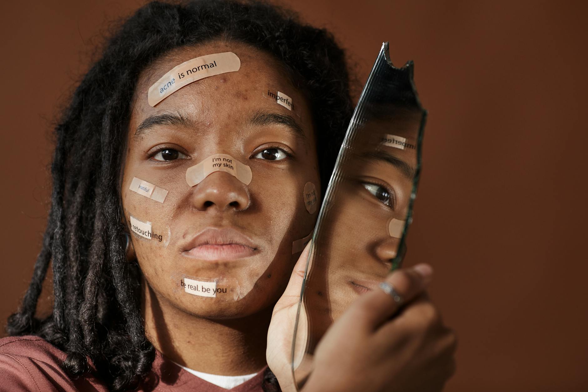 Acne Industry Growth Continues Into 2026 - Featured image