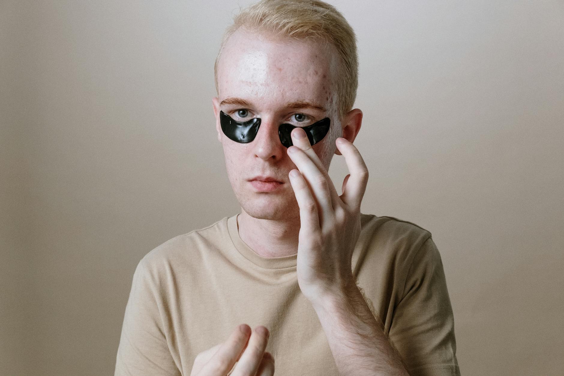 Common Fixed-Combination Acne Medications and Their Specific Strengths