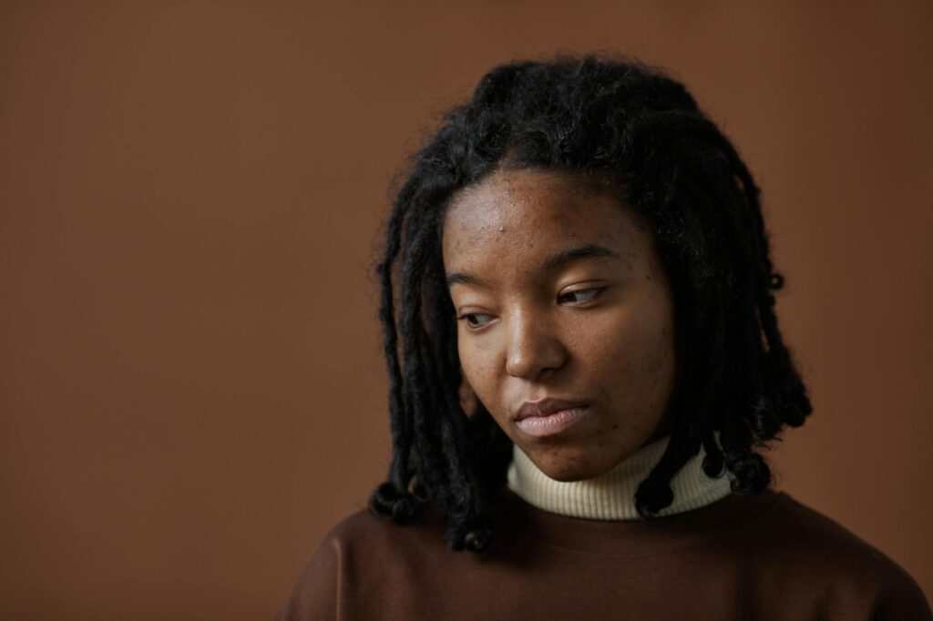 Experts Say Acne Is No Longer Just a Teen Issue - Featured image