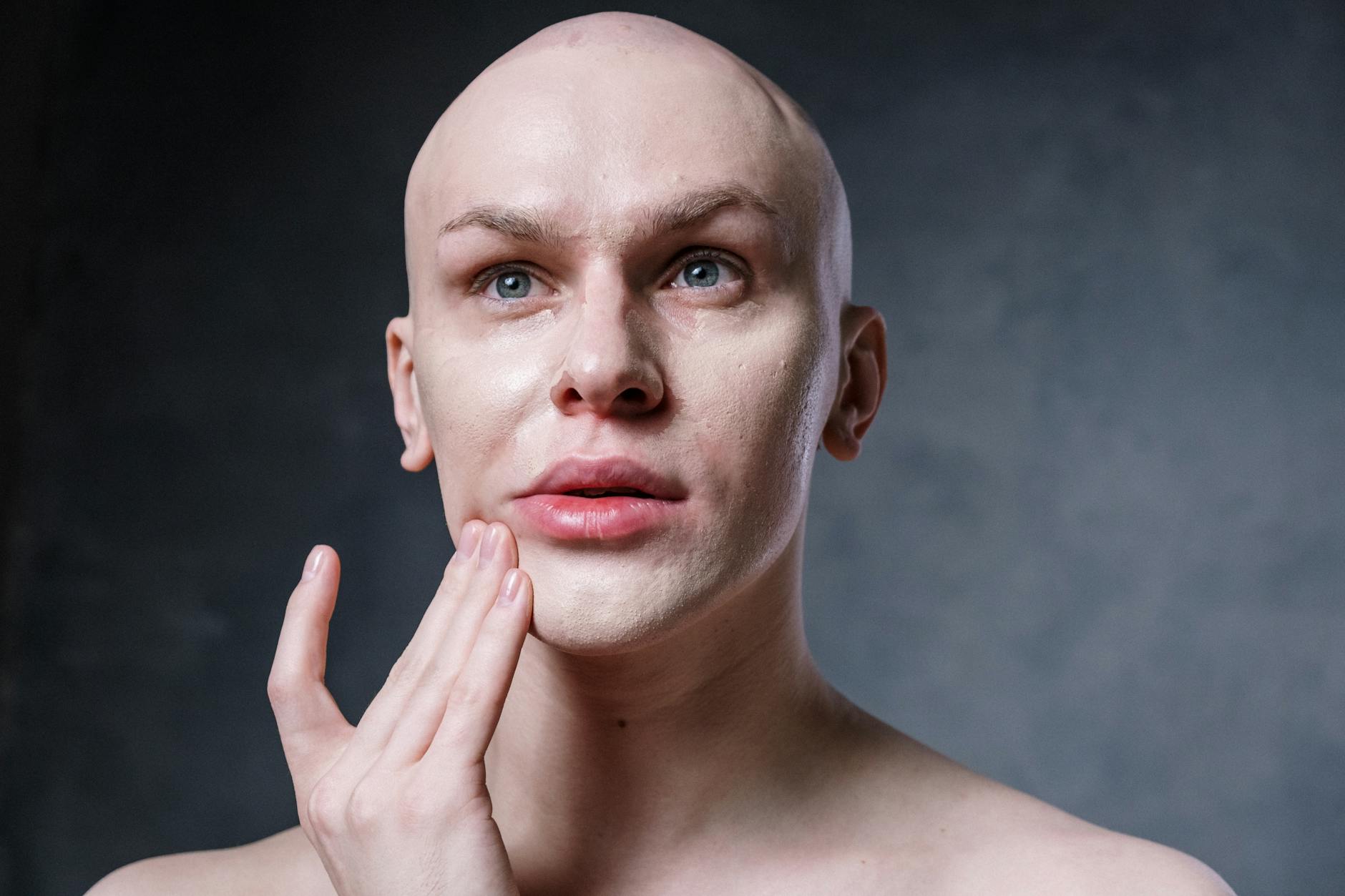 Gender Differences in Acne Social Anxiety — and Why They Matter