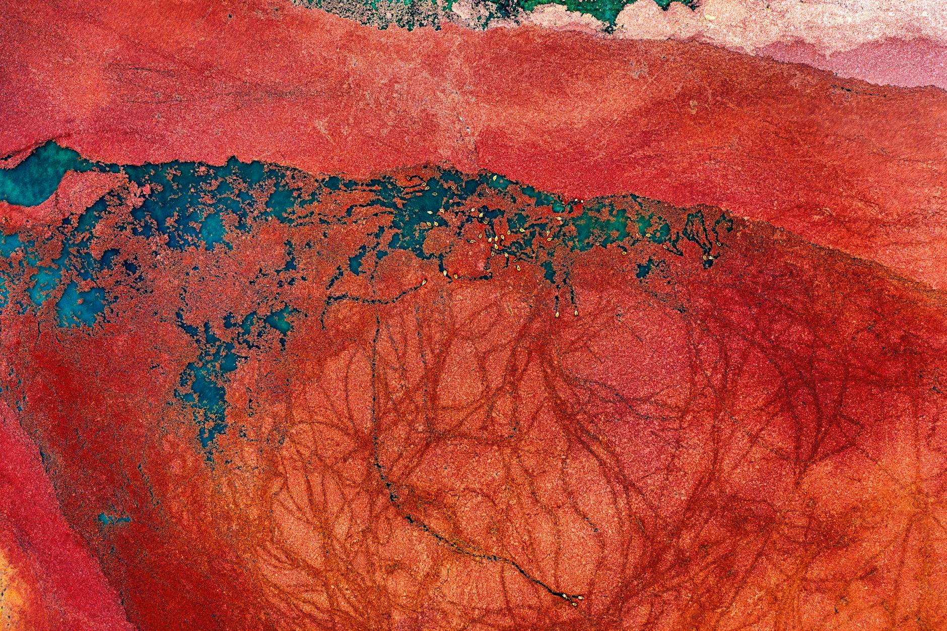 How Do Blood Vessels Respond to Acne Inflammation?