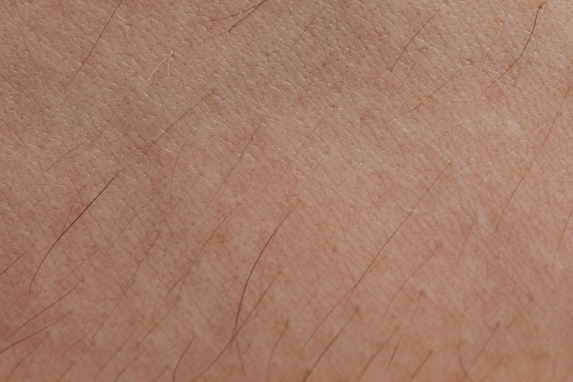 How Does Aerolase's 650-Microsecond Technology Prevent Pigmentation Damage on Darker Skin?