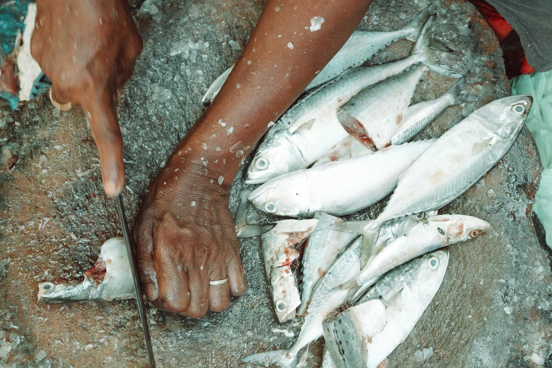 How Does Gut Dysbiosis Trigger Breakouts on Your Skin?