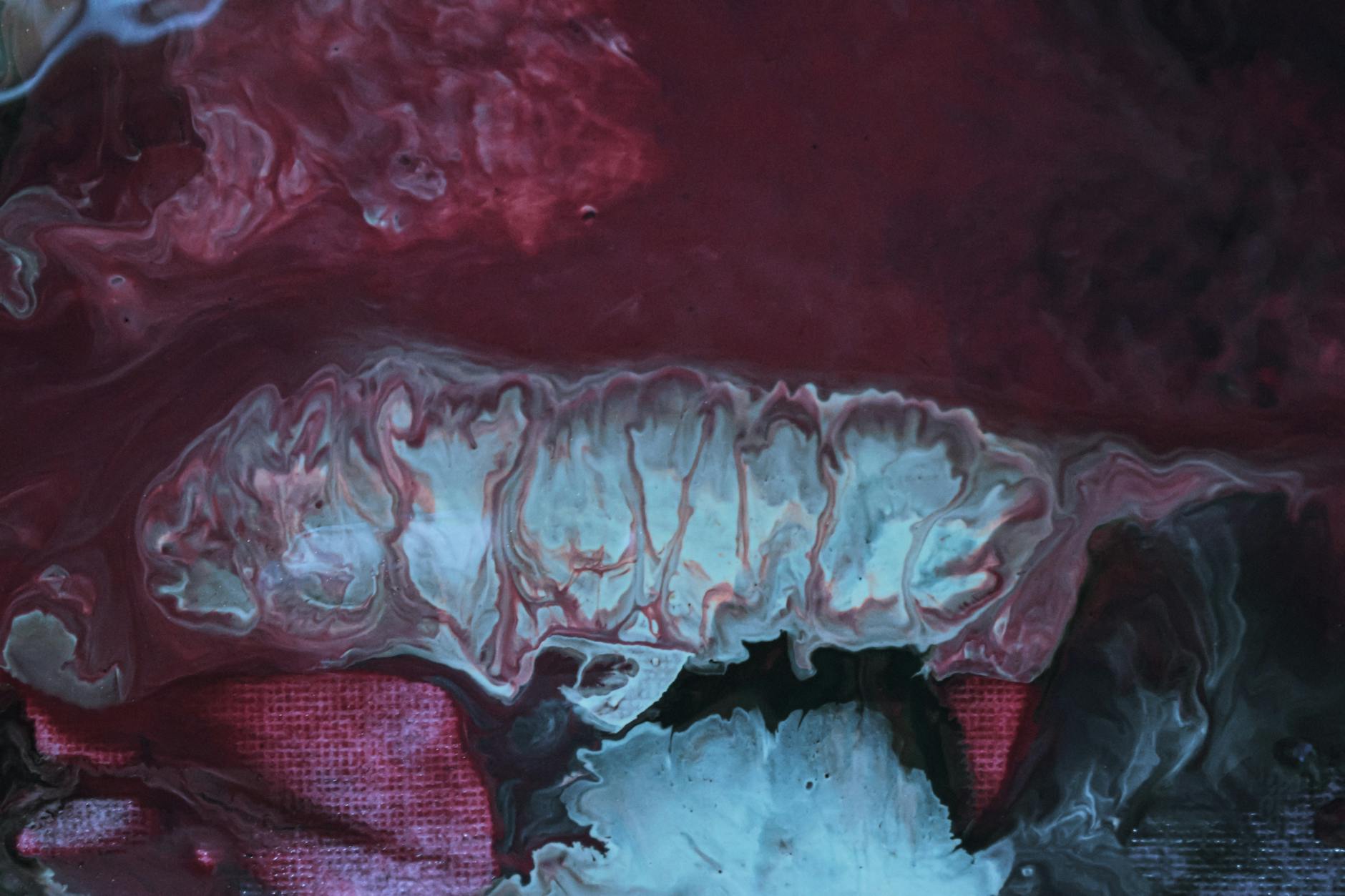 How Does Internal Inflammation Actually Trigger Acne Formation?