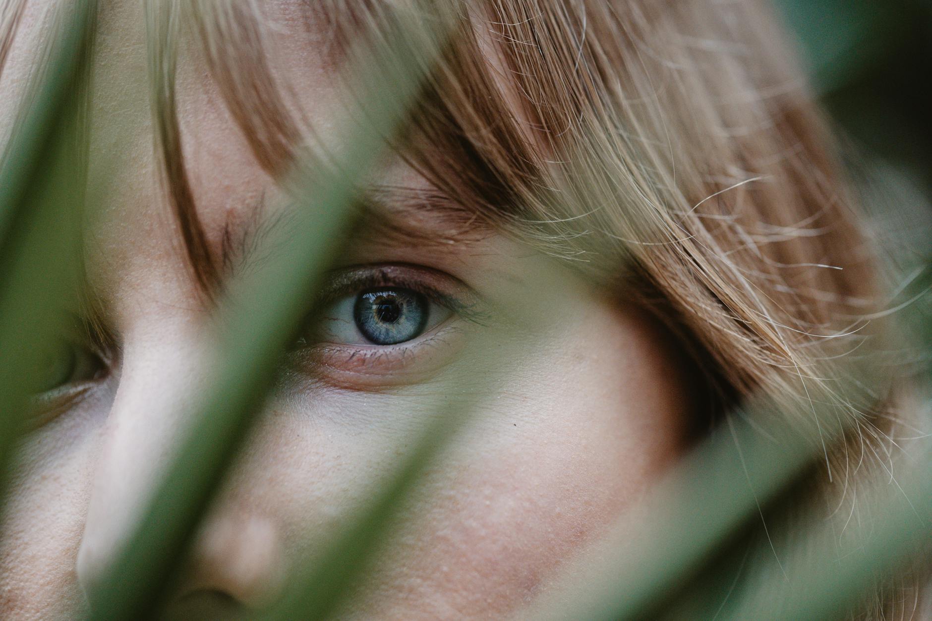 How Does Secret RF Stimulate Collagen and Improve Acne Scars?