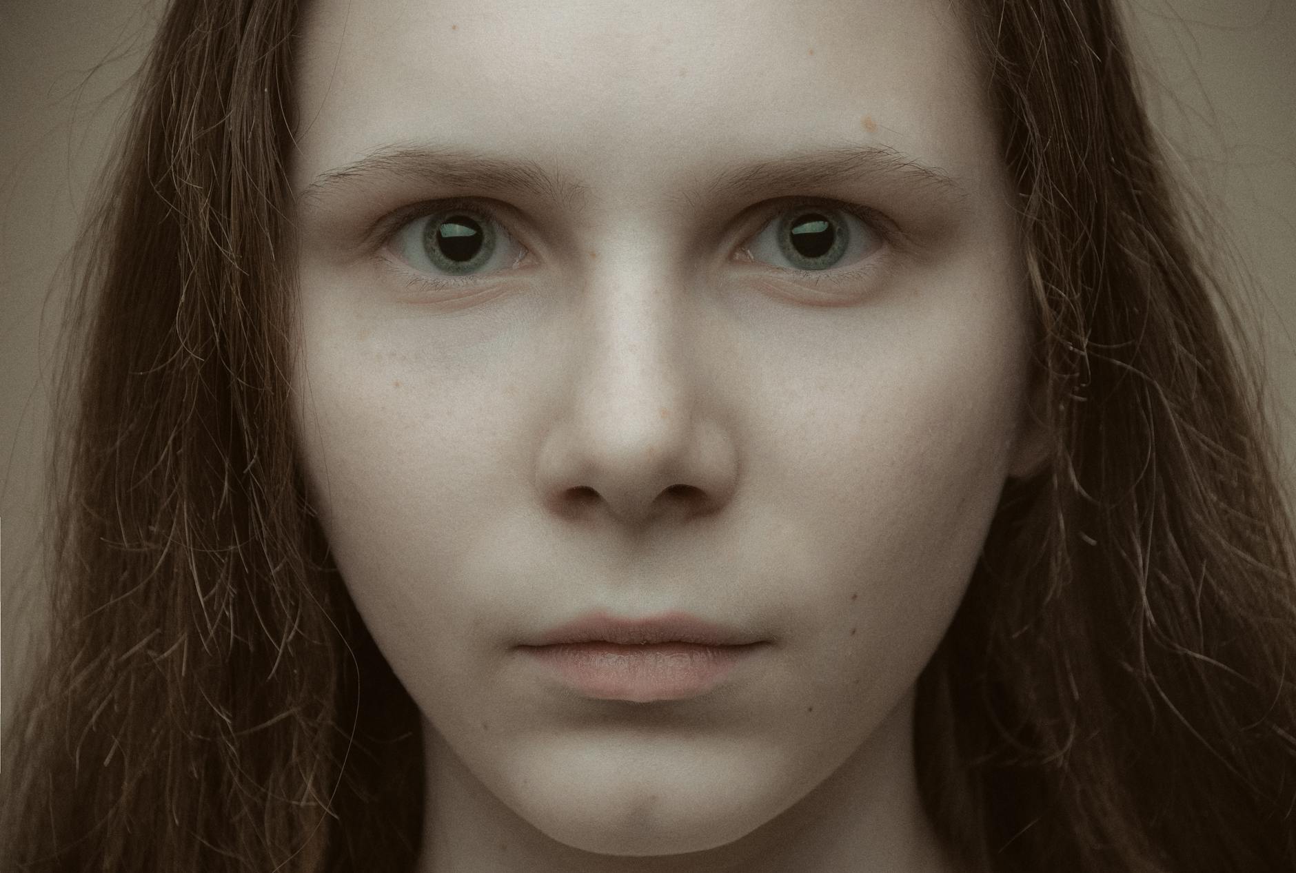 How Does Seysara Differ From Older Tetracycline Antibiotics?