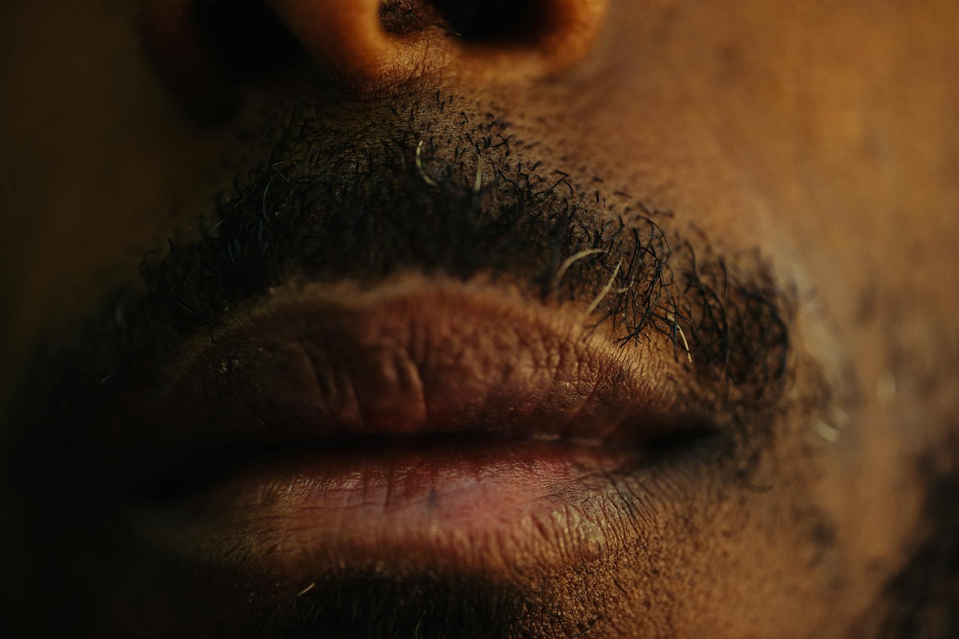 How Does the Lumenis M22 Target Vascular Acne Marks?