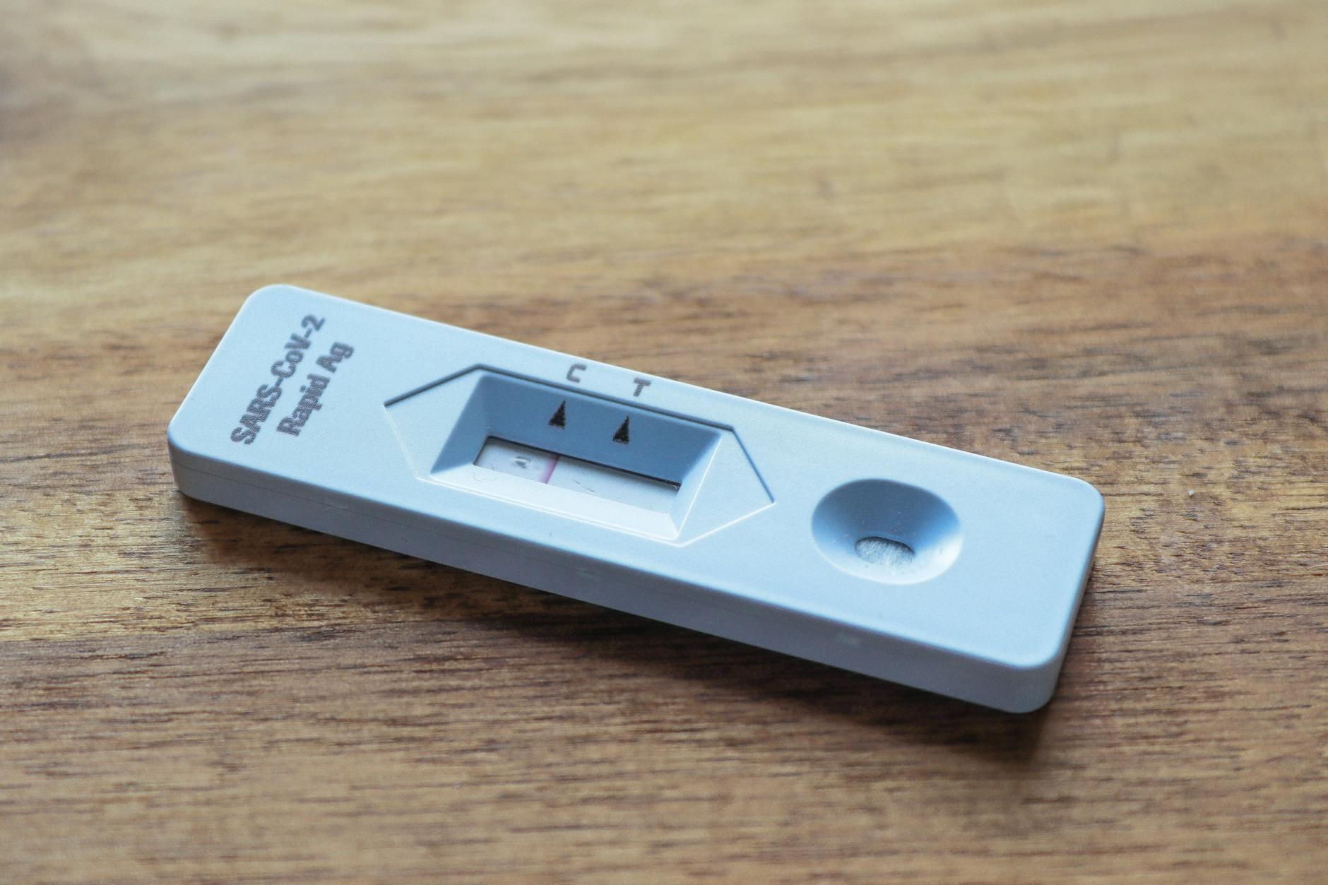 How Is the 24-Hour Urine Cortisol Test Performed and What Should You Expect?