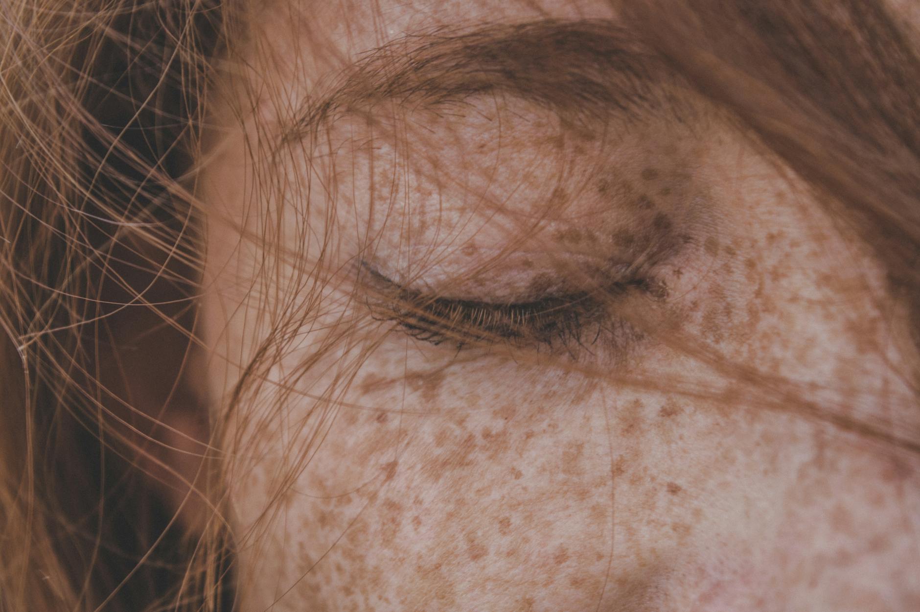 How Long Do Dark Spots Actually Take to Fade?