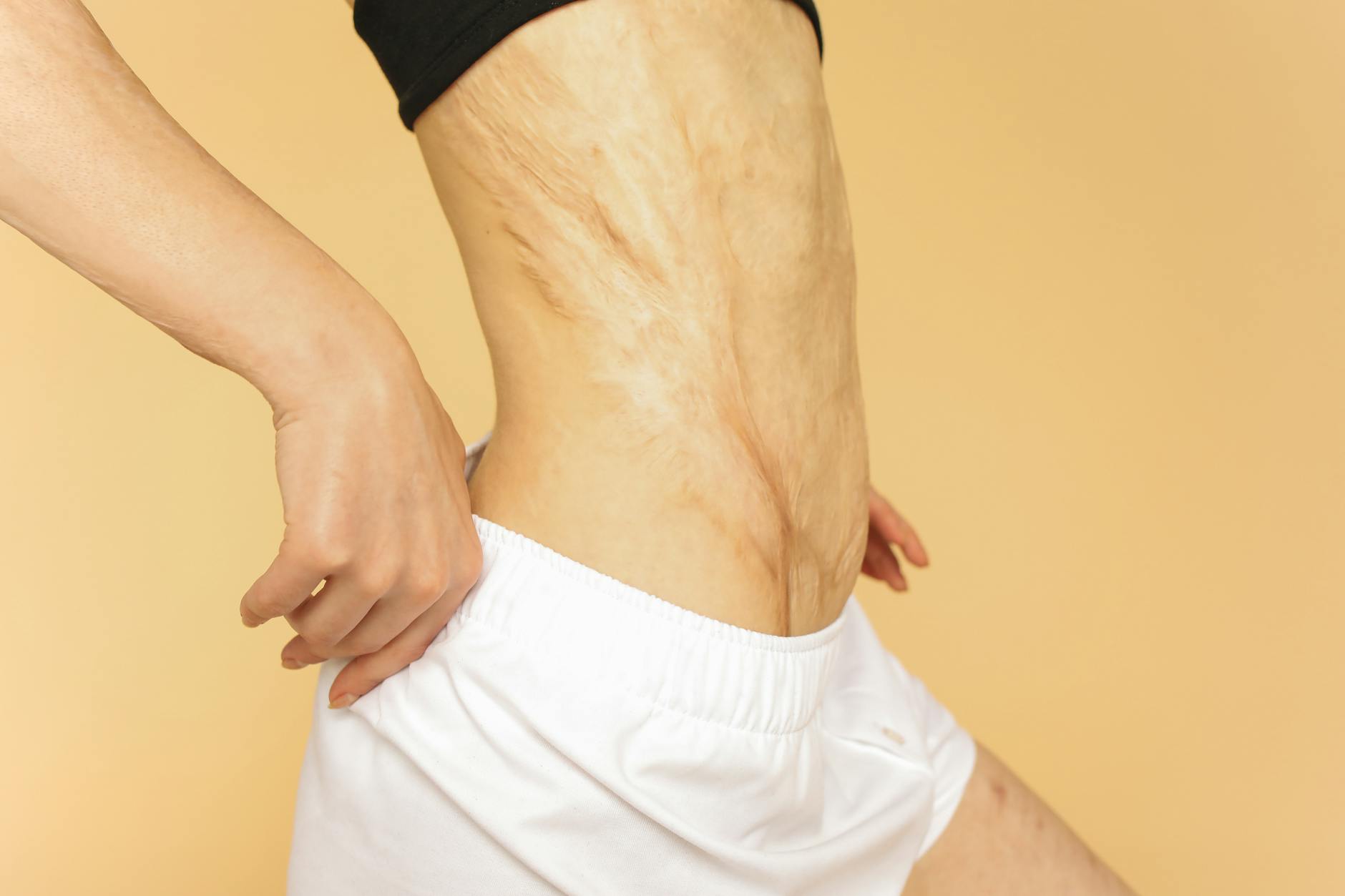 How Picking and Re-Irritation Extend Healing Time