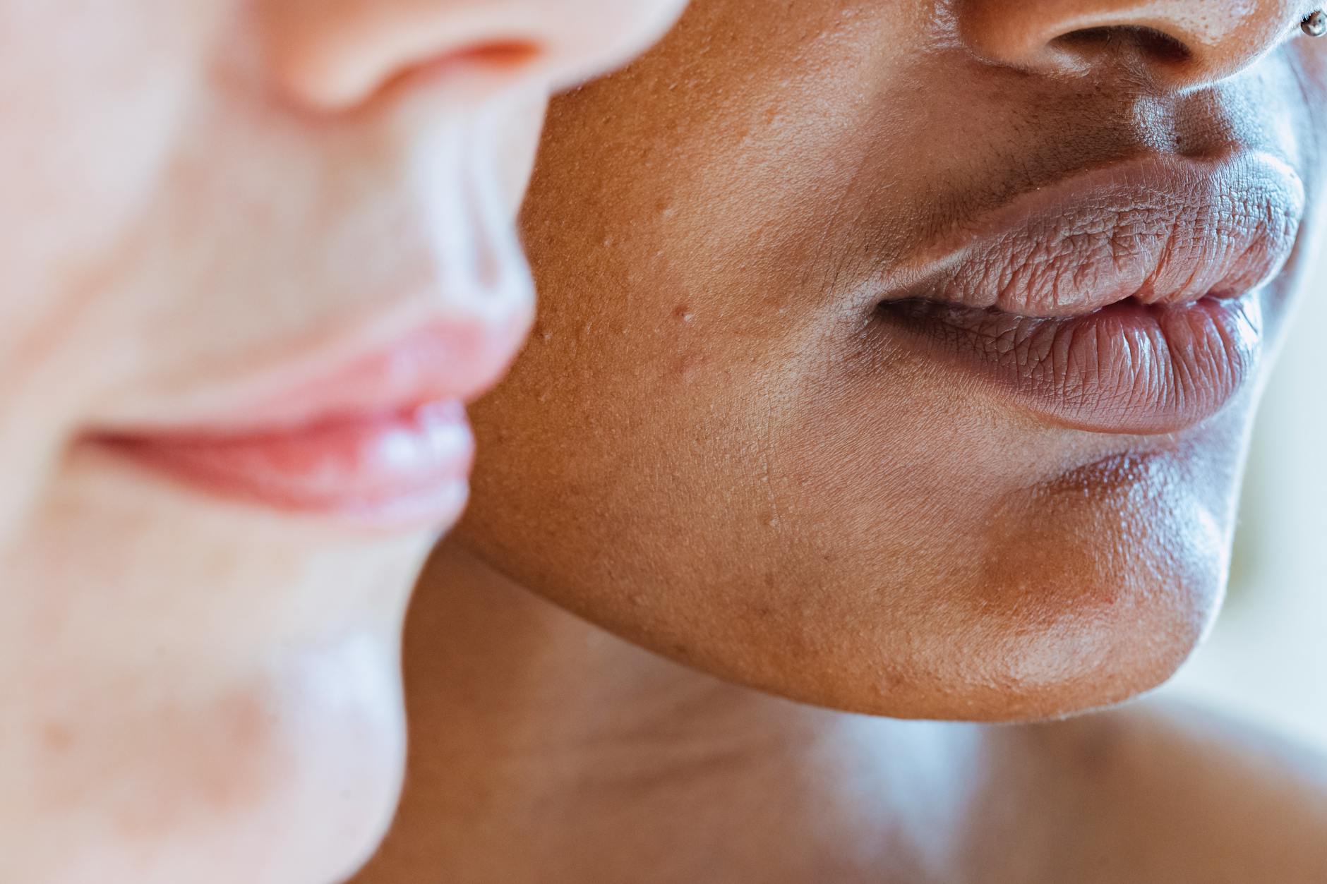 How to Fade Dark Marks Without Using Harsh Treatments - Featured image