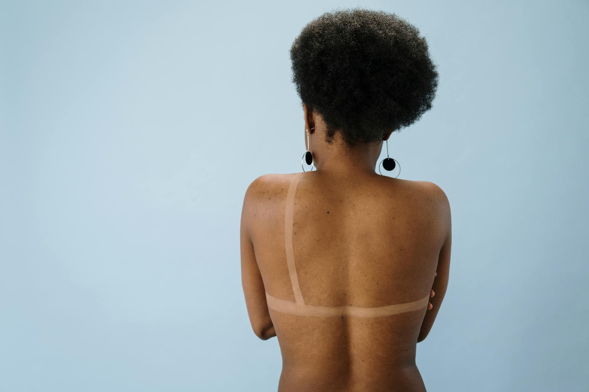 Hyperpigmentation Risk and Why Darker Skin Types Face Different Complications After PDT