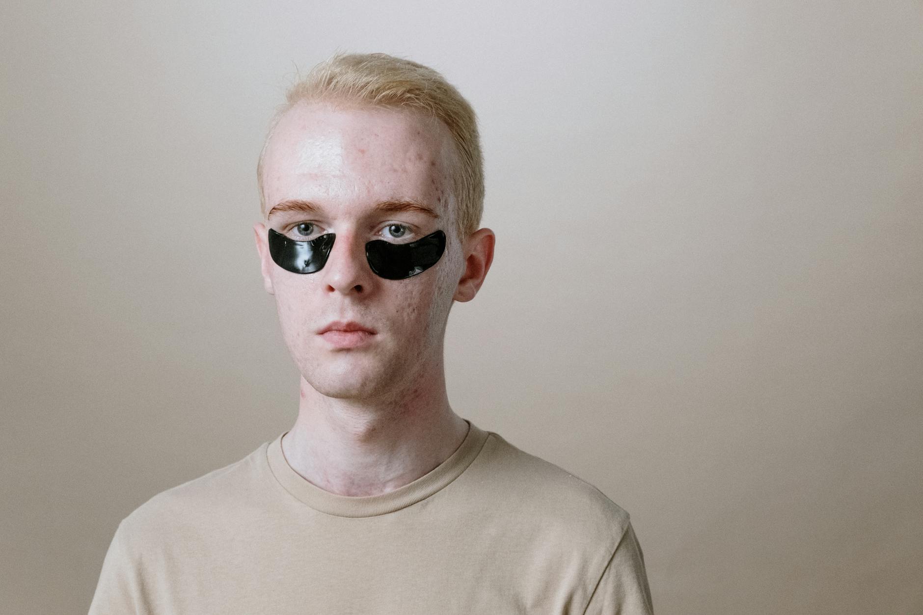 Popular Acne Medication Faces New Safety Questions - Featured image