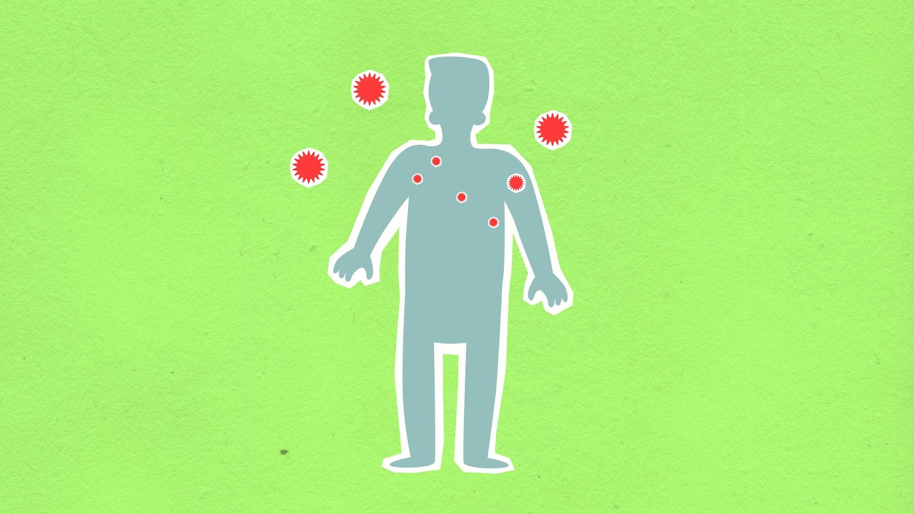 Preventing Complications - Infection Risk and Optimal Wound Healing