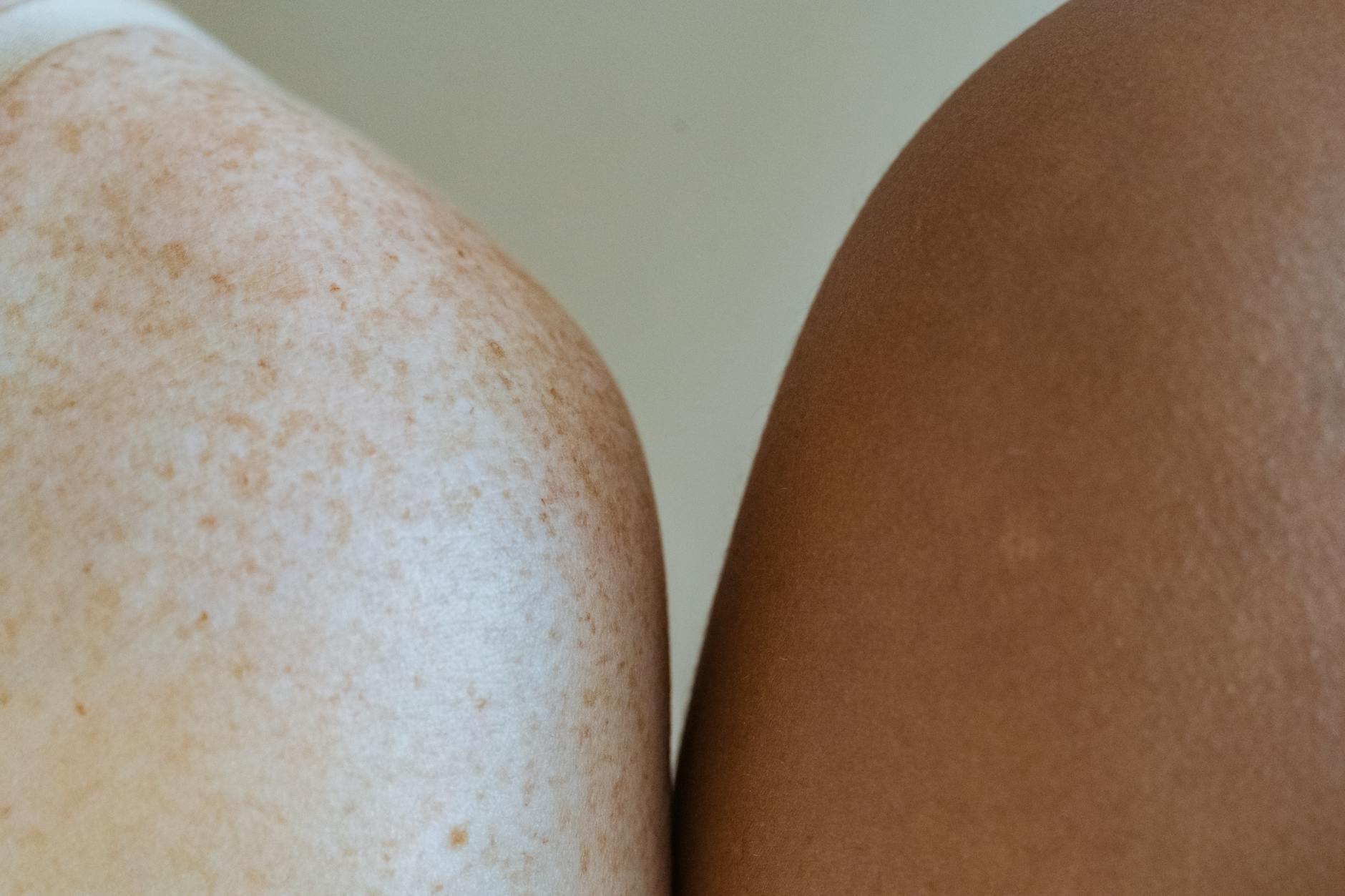 Real Skin Stories That Are Actually Shifting Culture