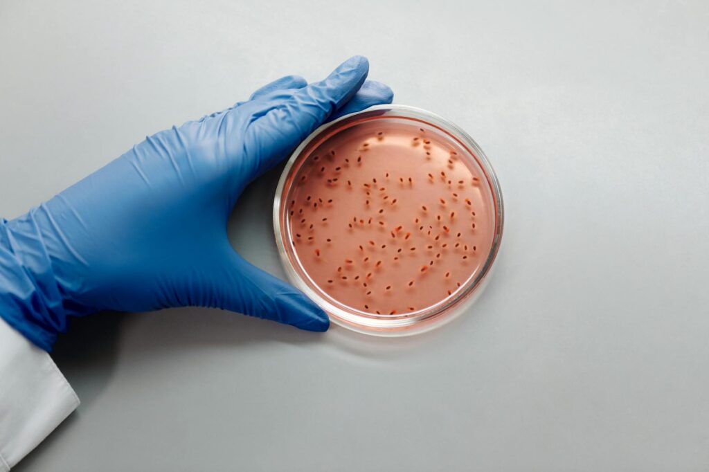 Scientists Identify New Bacteria Strain Behind Persistent Acne - Featured image