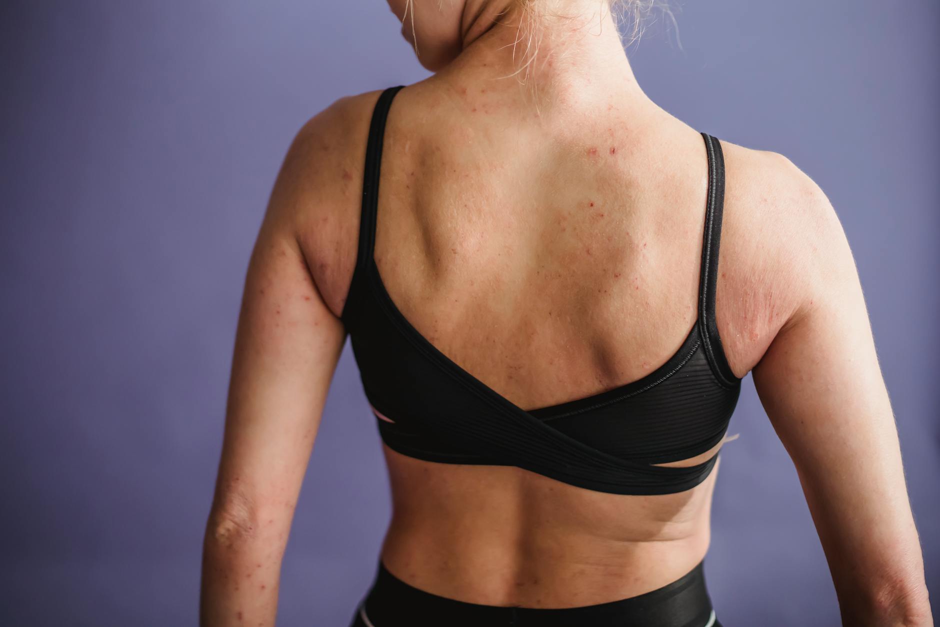 Stress, Cortisol, and the Neuroendocrine Axis