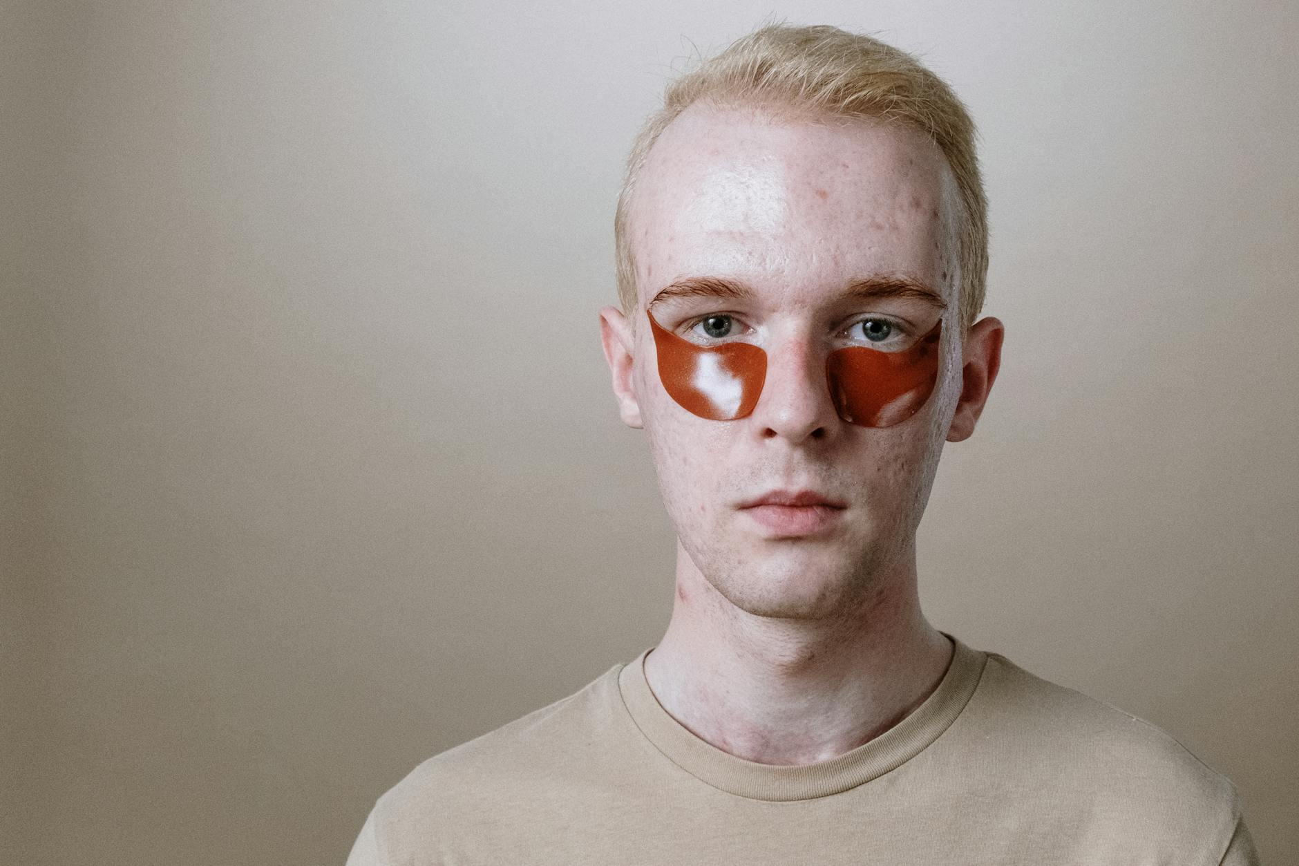 What a Tretinoin and Niacinamide Compound Does for Acne - Featured image