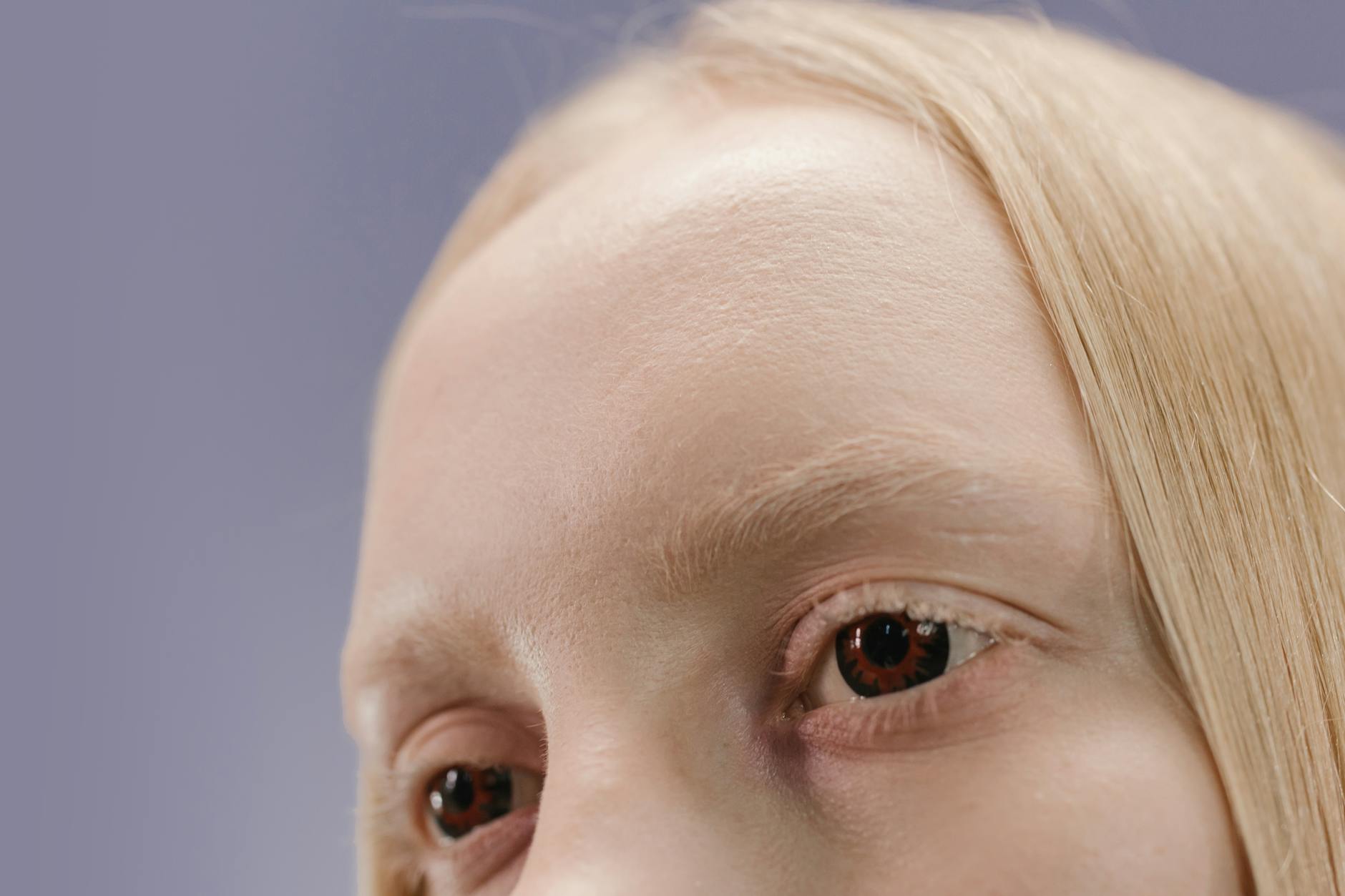 What Agnes RF Selective Sebaceous Gland Treatment Does for Acne - Featured image