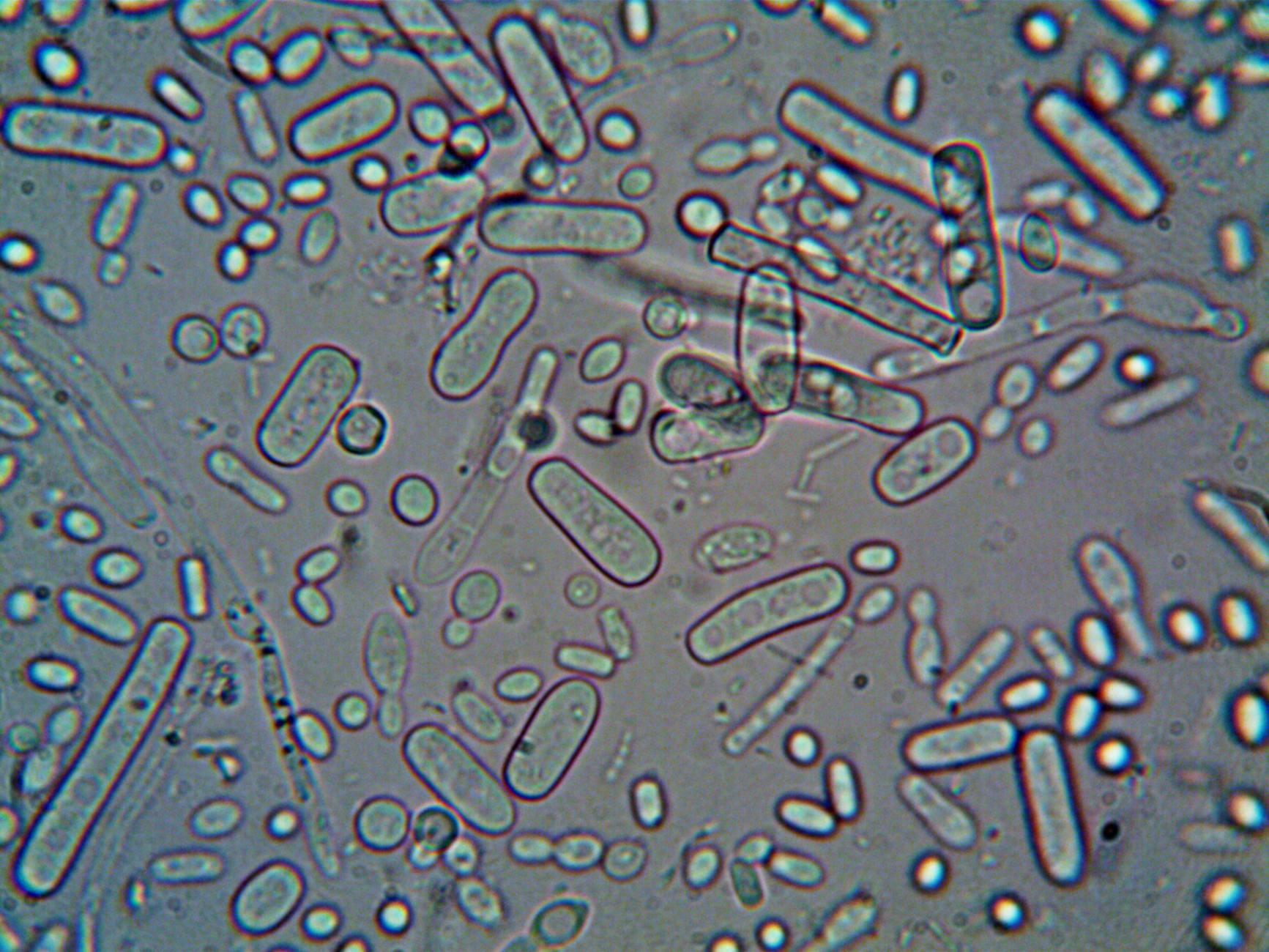 What Bacterial Culture Testing Reveals About Antibiotic-Resistant Acne - Featured image