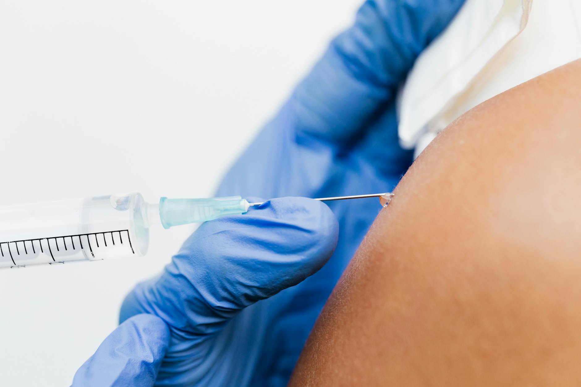 What Bleomycin Injections Do for Resistant Keloid Acne Scars - Featured image