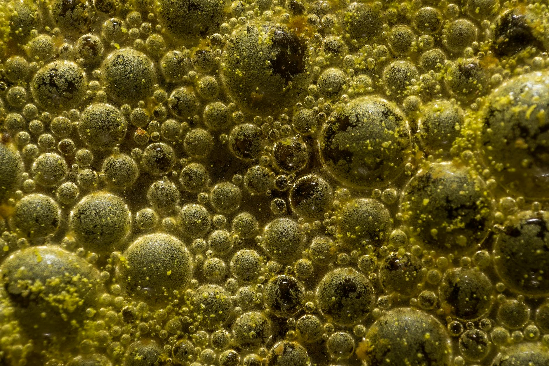 What Causes Nodules to Form After Subcision?