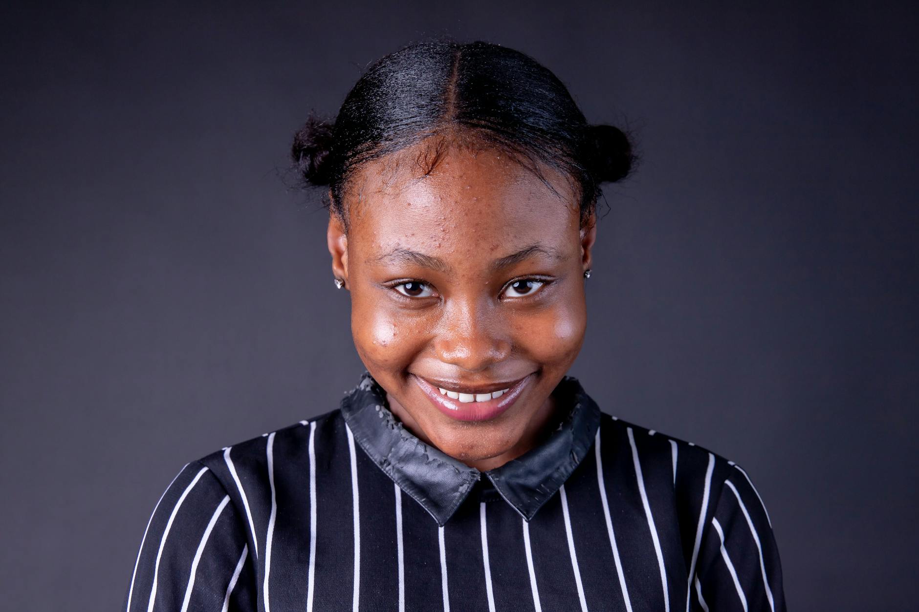 What Causes Pimples to Keep Returning to the Same Exact Spot?