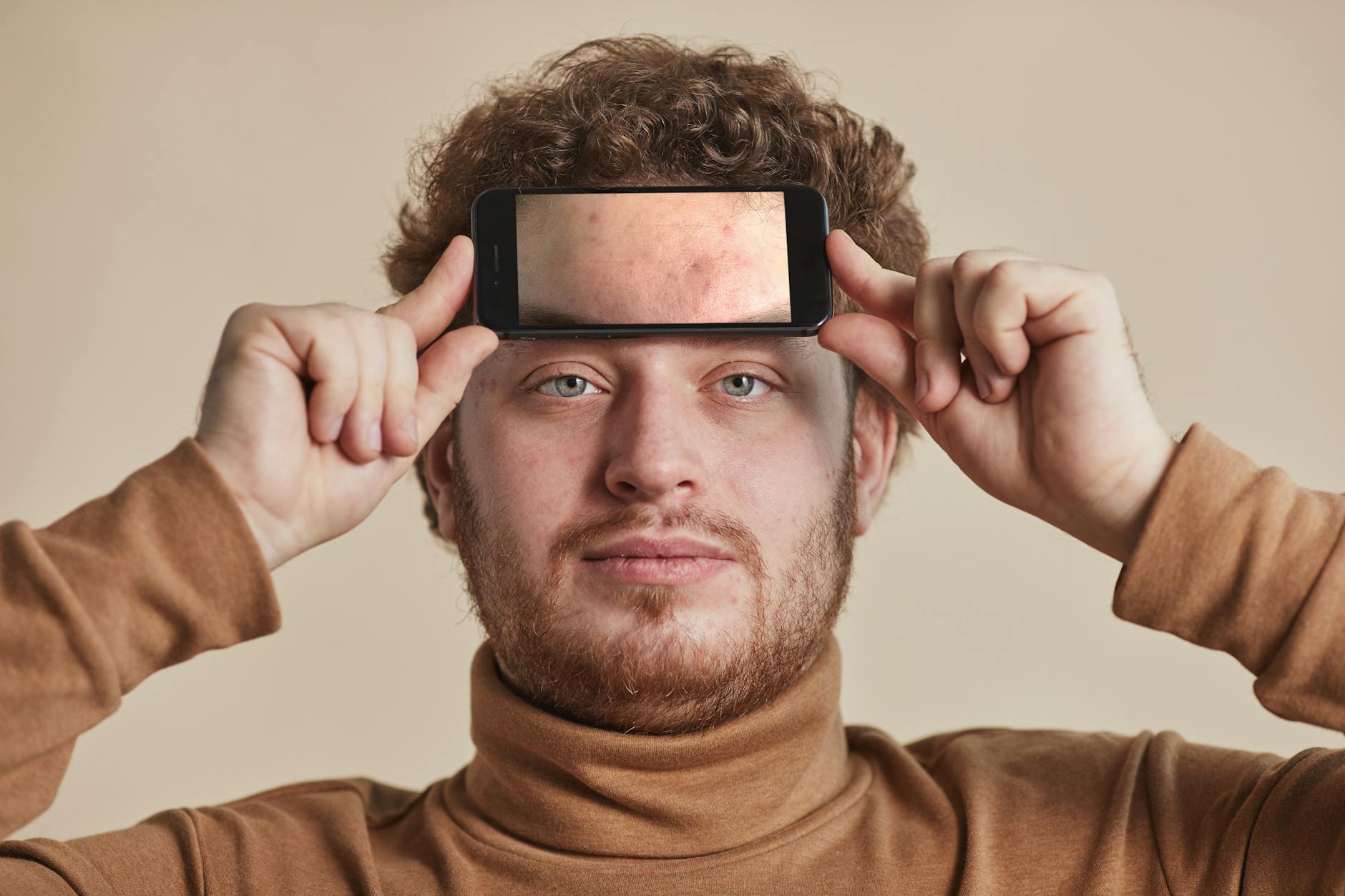What Causes Tiny Bumps on Forehead That Never Turn Into Pimples - Featured image