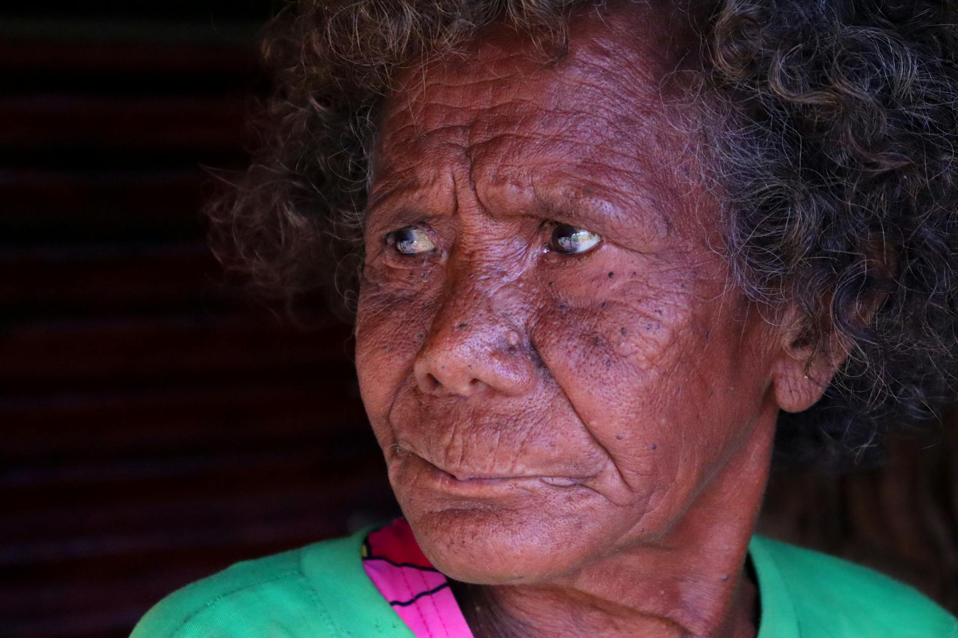 What CB-5945 Is—Understanding the Actual Drug Classification