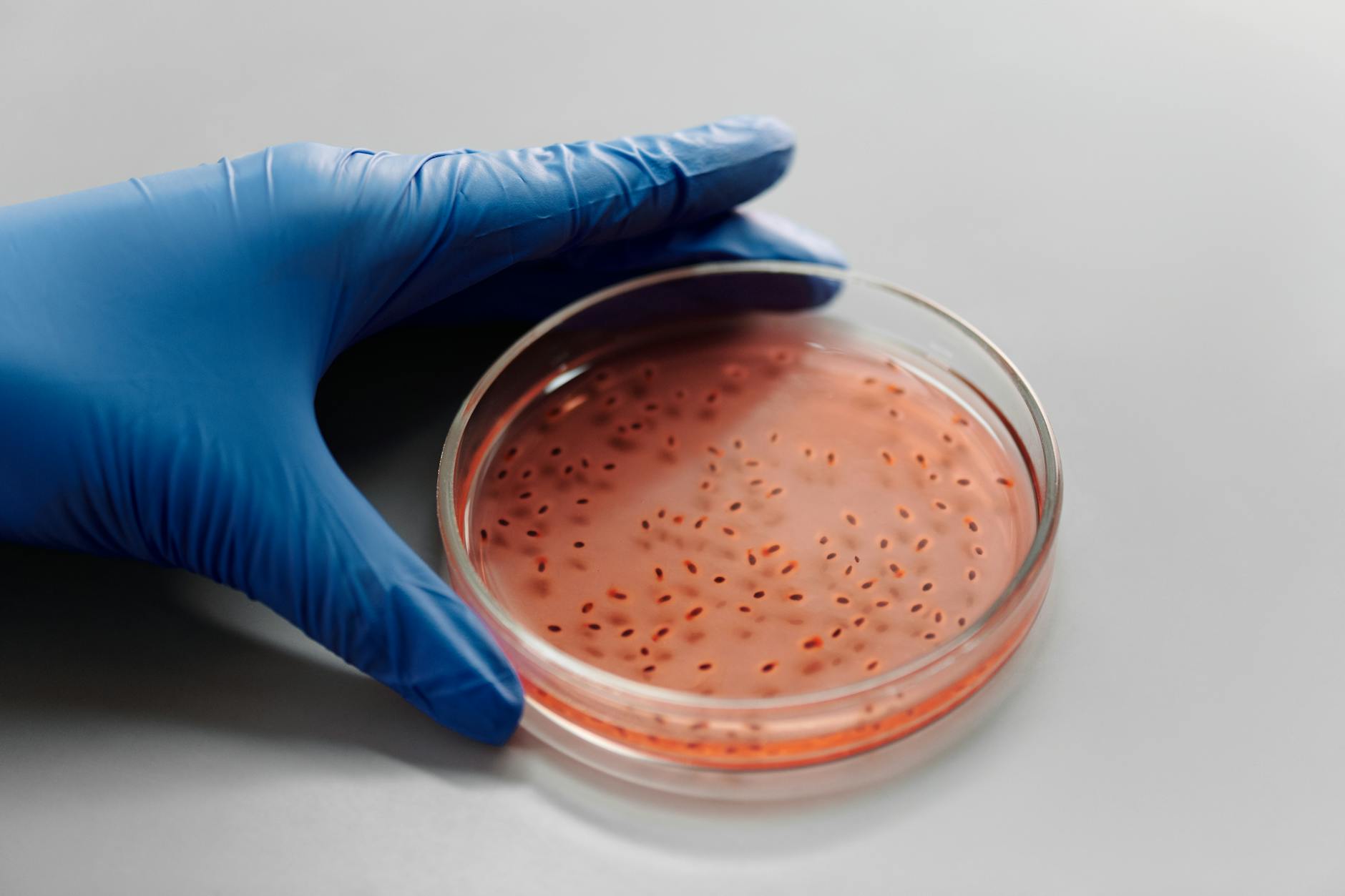 What CRISPR Research on Acne Bacteria Is Showing - Featured image