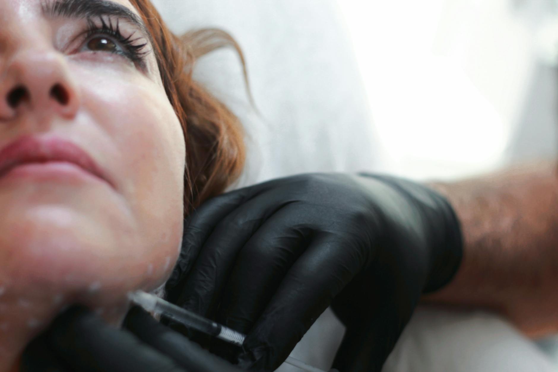 What EGF Injection Does for Acne Scar Collagen Synthesis - Featured image