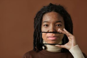 What Face Mapping for Acne Gets Wrong - Featured image