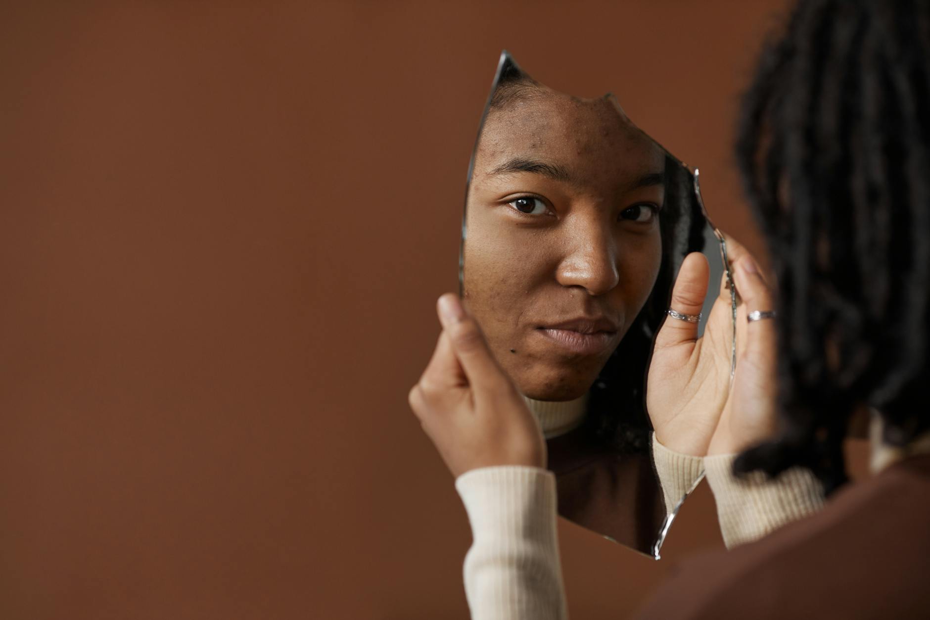 What Good Molecules Niacinamide Does for Acne Skin - Featured image