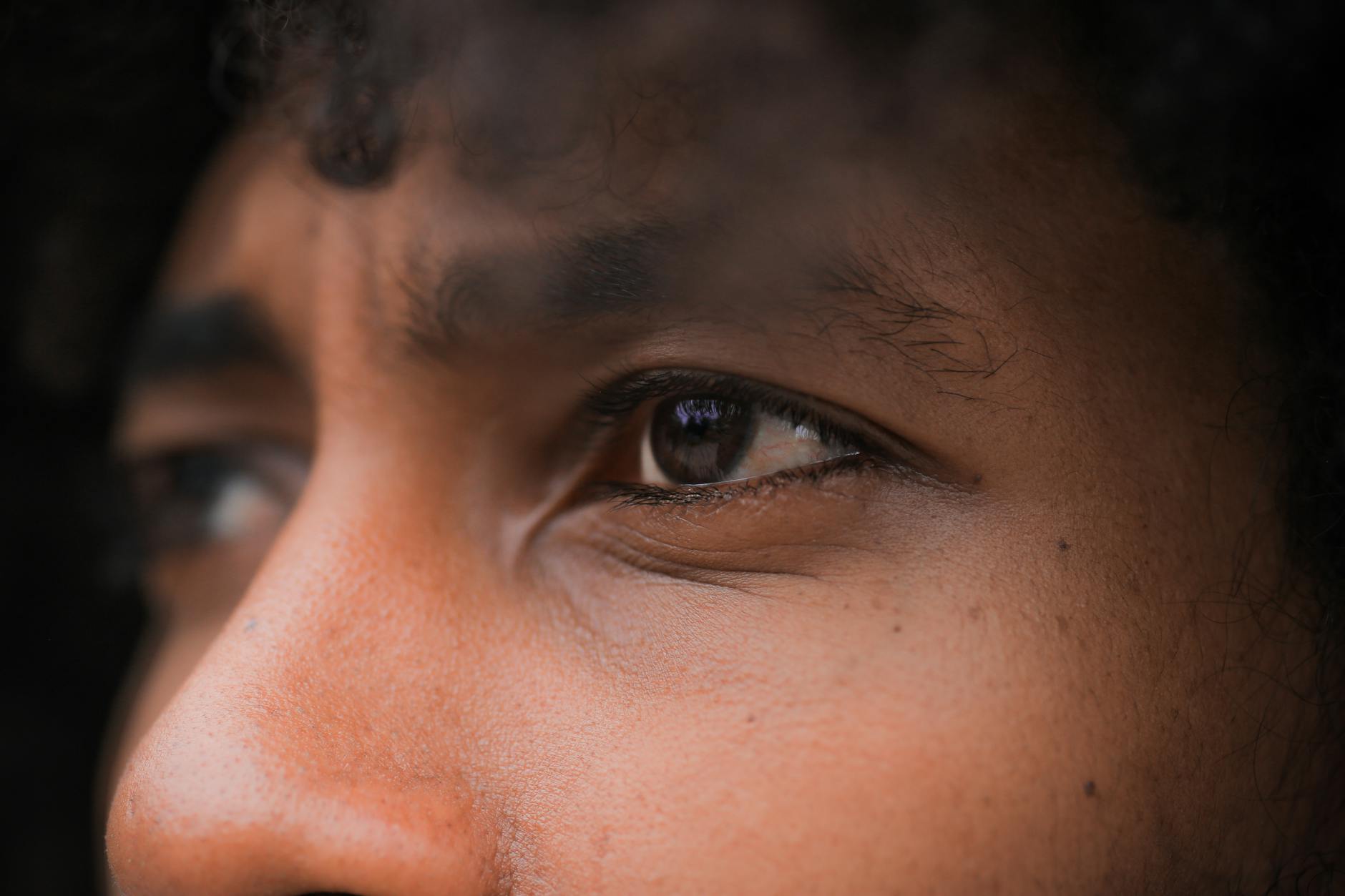 What Makes Deep Cystic Acne So Difficult to Treat?