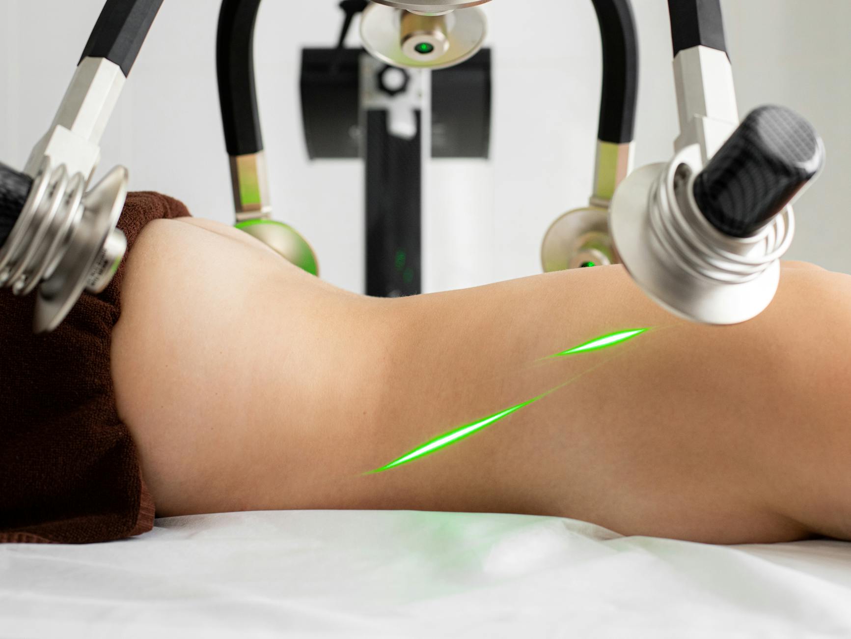What Pulsed Dye Laser Does for Post-Procedure Redness - Featured image