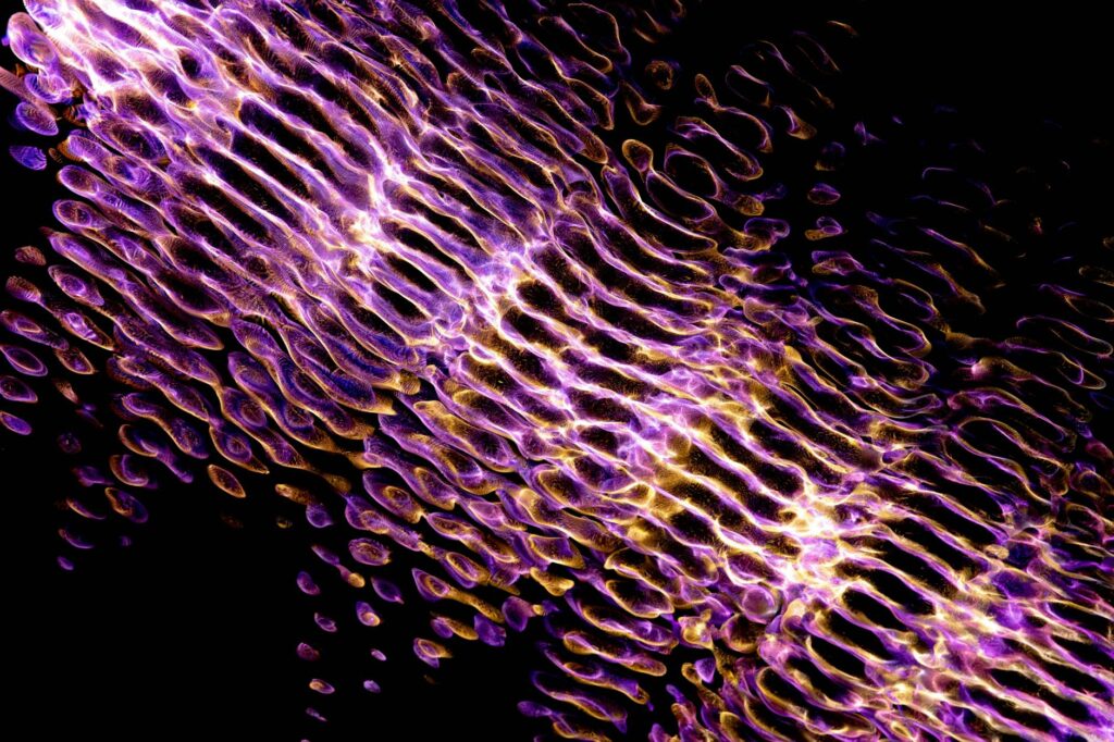 What Reflectance Confocal Microscopy Shows in Acne Skin - Featured image