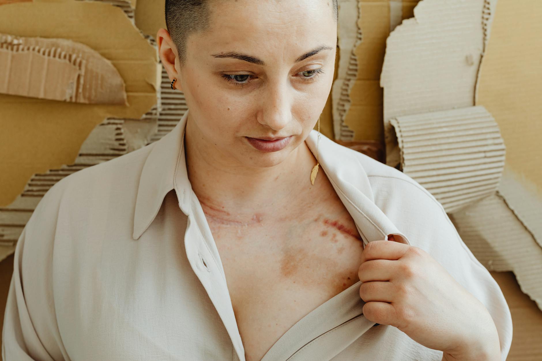 What Scar Tissue Hardness Tells a Dermatologist About Treatment Plan - Featured image