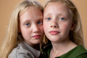 What Twin Studies Reveal About Acne Heritability - Featured image