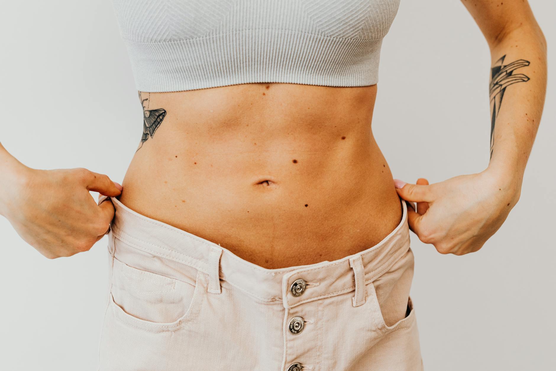 What Weight Loss Does to Acne Scar Appearance - Featured image