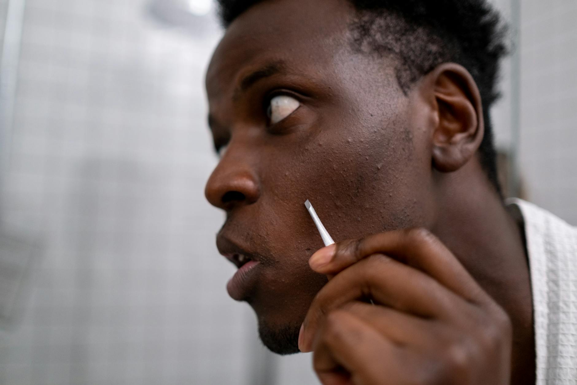 What Would Fix the Acne Care Gap in Underserved Communities - Featured image