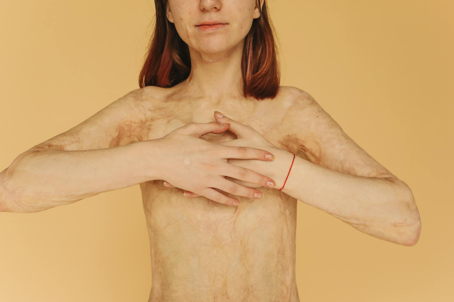 What YAP Pathway Inhibition Does for Scar Tissue - Featured image