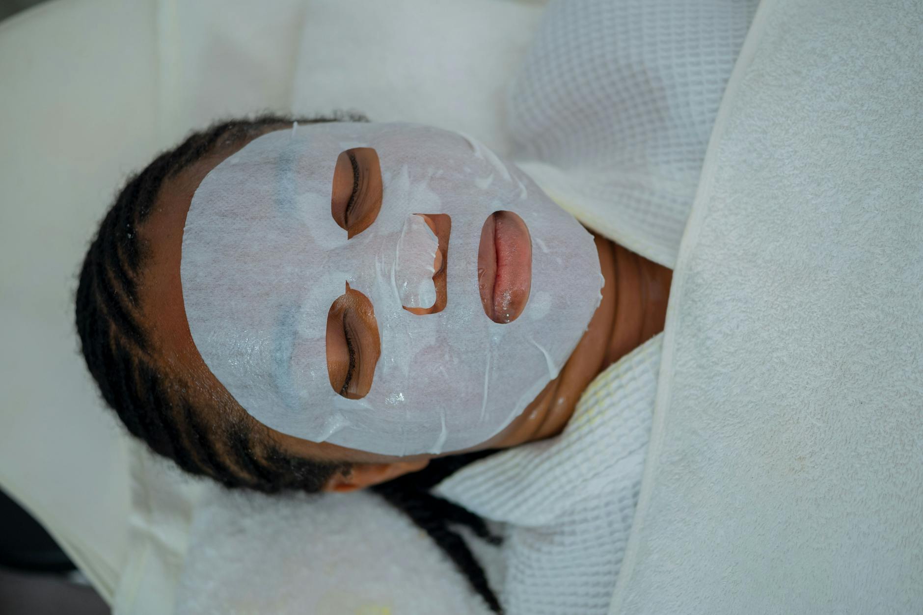 When Standard Treatments Aren't Working—Severe Acne and Advanced Options