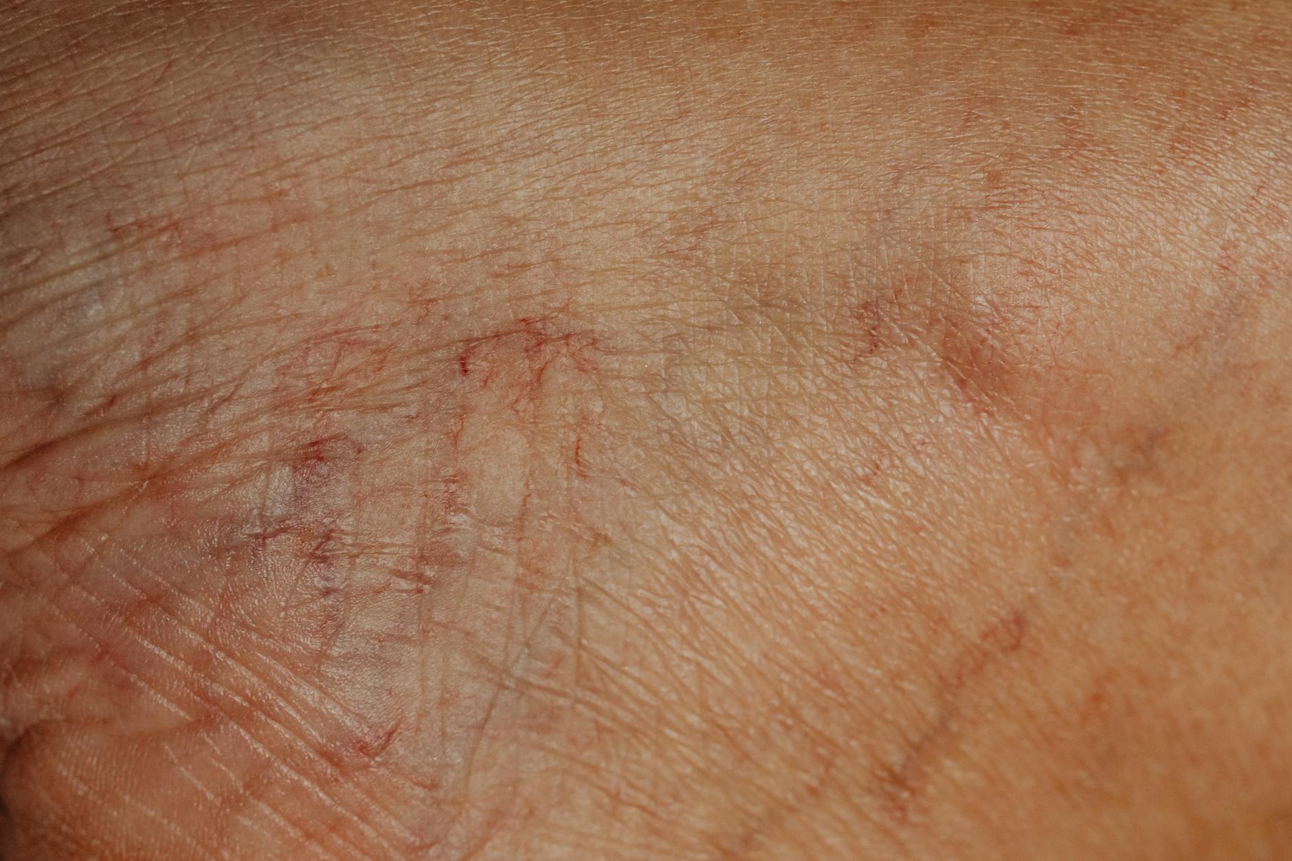 Where Do Dermatologists Find Acne Research?