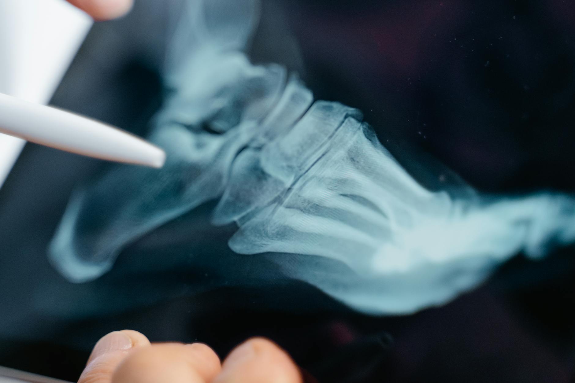 Why 3D Vectra Imaging Helps Track Acne Scar Improvement - Featured image