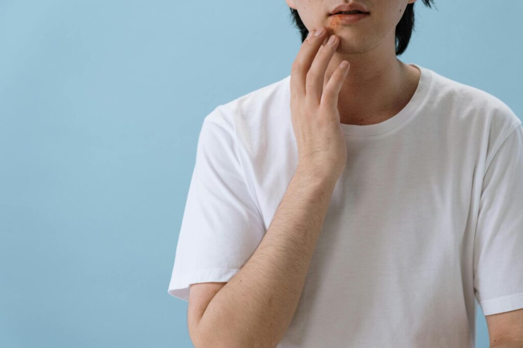 Why Acne Appears Around the Jawline and What It Signals Internally - Featured image