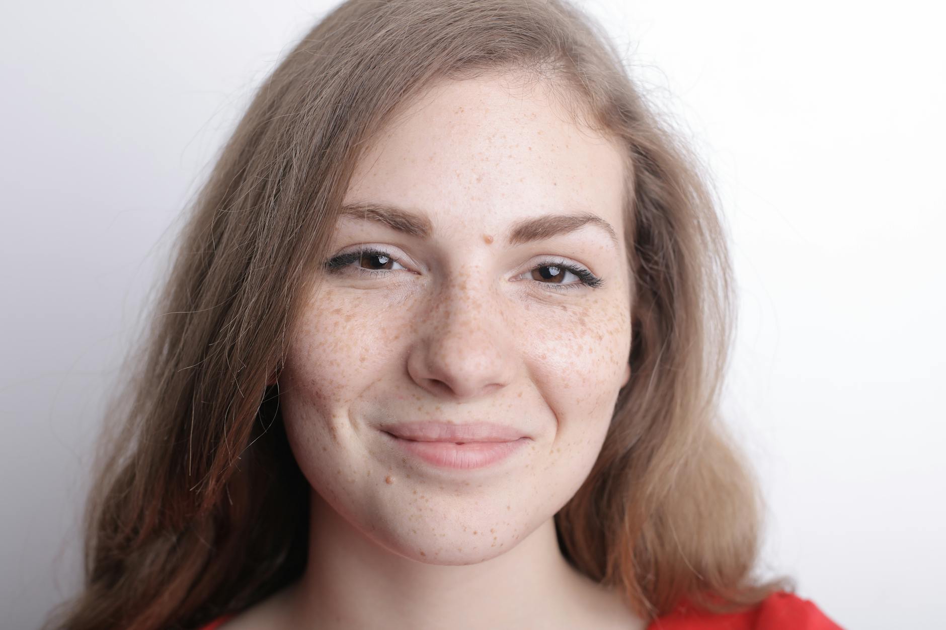 Why Acne Has a Stronger Genetic Component Than Most People Think - Featured image
