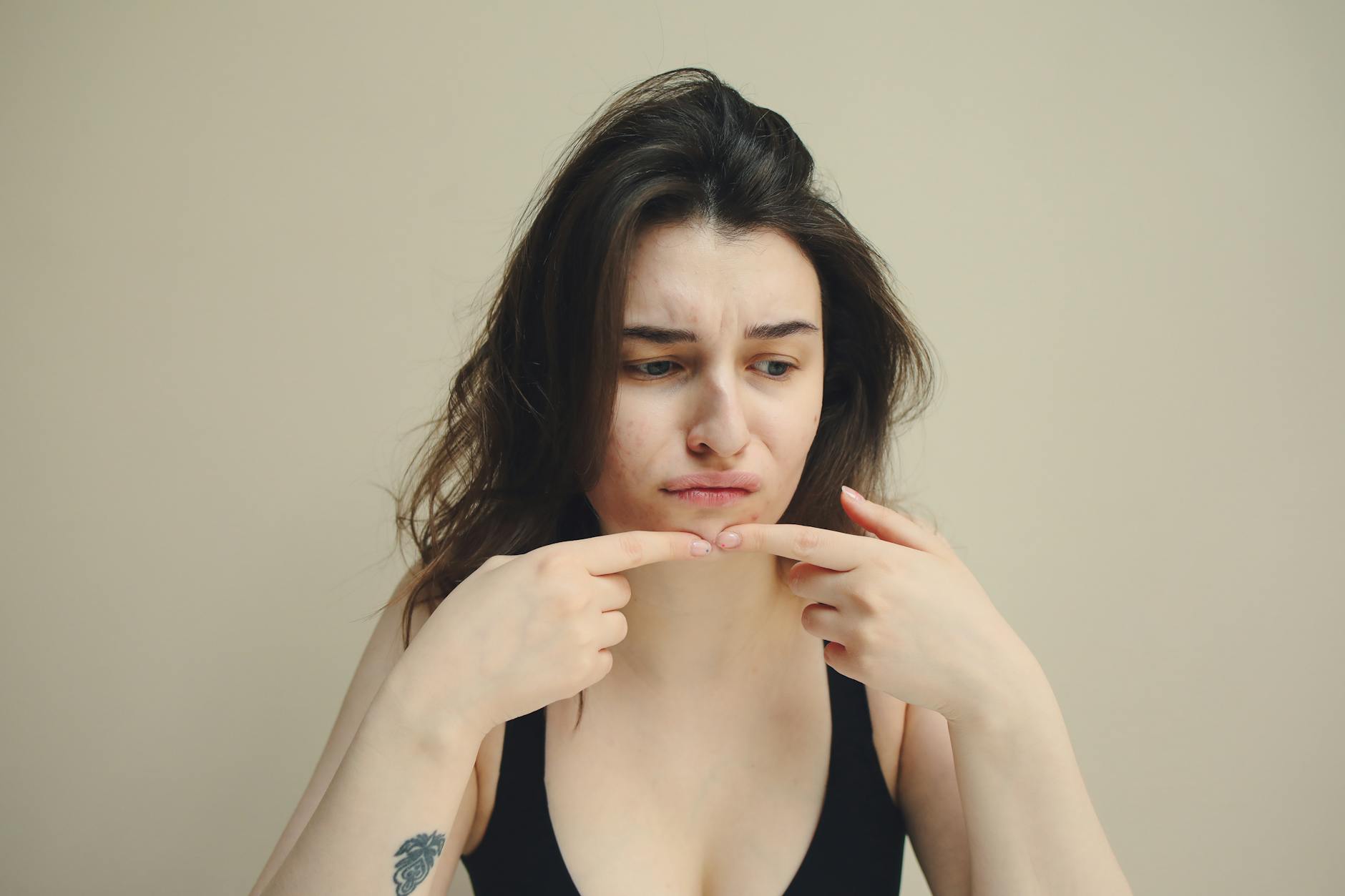 Why Acne Keeps Coming Back in the Same Spot and What It Means for Your Skin - Featured image